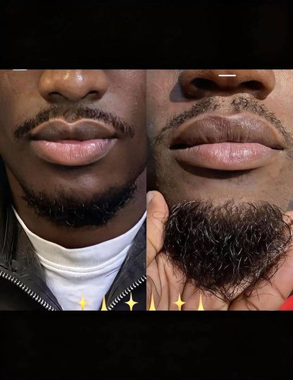 🔥 DERMAGLOW PRO™ – KIT CROISSANCE BARBE