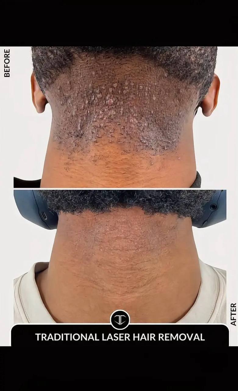 🔥 DERMAGLOW PRO™ – KIT CROISSANCE BARBE